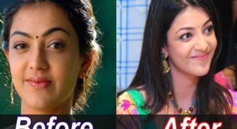 శ్రీదేవి నుండి సమంత వరకు.. సర్జరీలు చేసుకొని సినిమాల్లో రాణించారు..సర్జరీకి ఎంత ఖర్చు చేశారంటే..!!