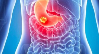 క‌డుపు నొప్పి నుంచి బ‌య‌ట ప‌డాలంటే.. వీటిని తీసుకోవాలి..!