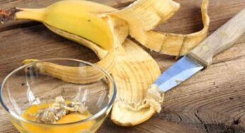 అర‌టి పండు తిని తొక్క పారేస్తున్నారా..? ఇది చదివితే అలా చేయ‌రు తెలుసా..?